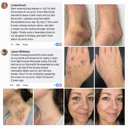 DERMAKLIN® BRUISESHIELD™ Recovery Cream